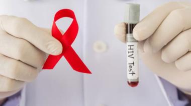 La eficacia de tratamientos antirretrovirales combinados hicieron del SIDA una enfermedad crónica