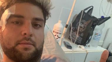 Le dispararon en la cabeza, pero vivió