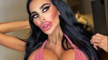 Gastó una fortuna para parecerse a una "Barbie" y este fue el resultado