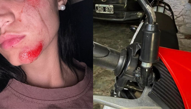 Buscan a un conductor que chocó a dos mujeres en moto en City Bell y se dio a la fuga