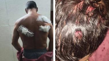 Violencia en Tolosa: quiso matar a cuchillazos al novio de su ex y terminó detenido