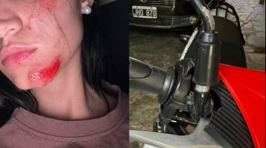 Buscan a un conductor que chocó a dos mujeres en moto en City Bell y se dio a la fuga