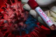 Alerta por la "Súper Gripe" H3N2: confirman la primera muerte en Argentina y crecen los casos