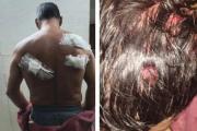 Violencia en Tolosa: quiso matar a cuchillazos al novio de su ex y terminó detenido